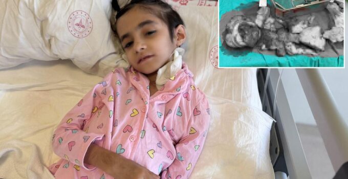 Dünyada ilk kez 3 kg’lık tümör 6,5 saatlik operasyonda alındı