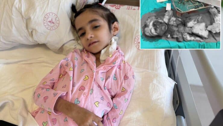 Dünyada ilk kez 3 kg’lık tümör 6,5 saatlik operasyonda alındı