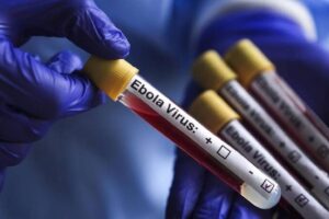 Ebola virüsü yazılı etiketli kan örneği tüpleri mavi eldivenli bir sağlık çalışanının elinde.