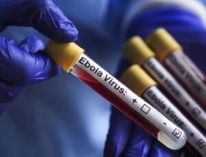 KKTC, Ebola’ya Karşı Yeni Önlemler Aldı