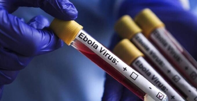 KKTC, Ebola’ya Karşı Yeni Önlemler Aldı